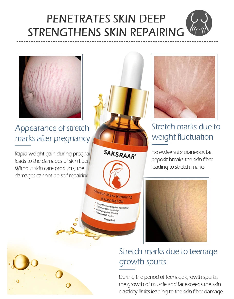 stretch marks remover essential oil