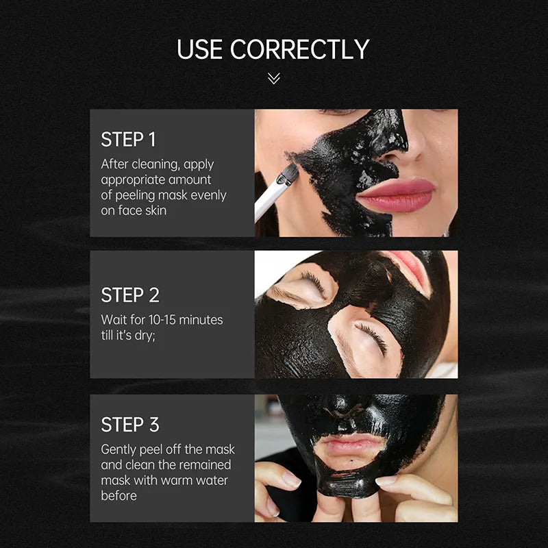 anti acne blackhead remover